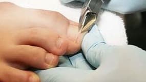 nagels knippen